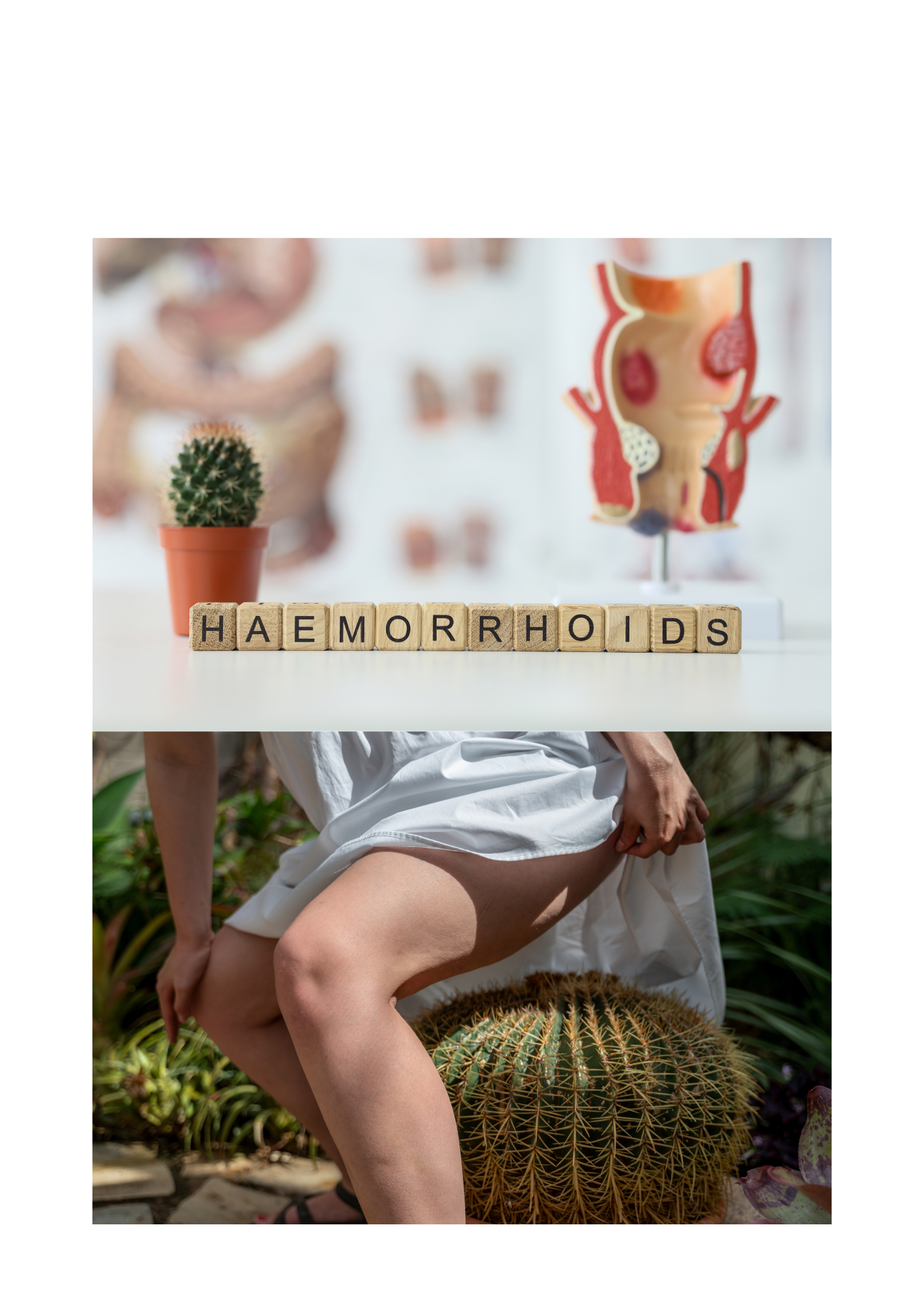 Piles Treatment Near Nagole Road – Gentle and Holistic Care at DR. Shwetha’s Homeopathy