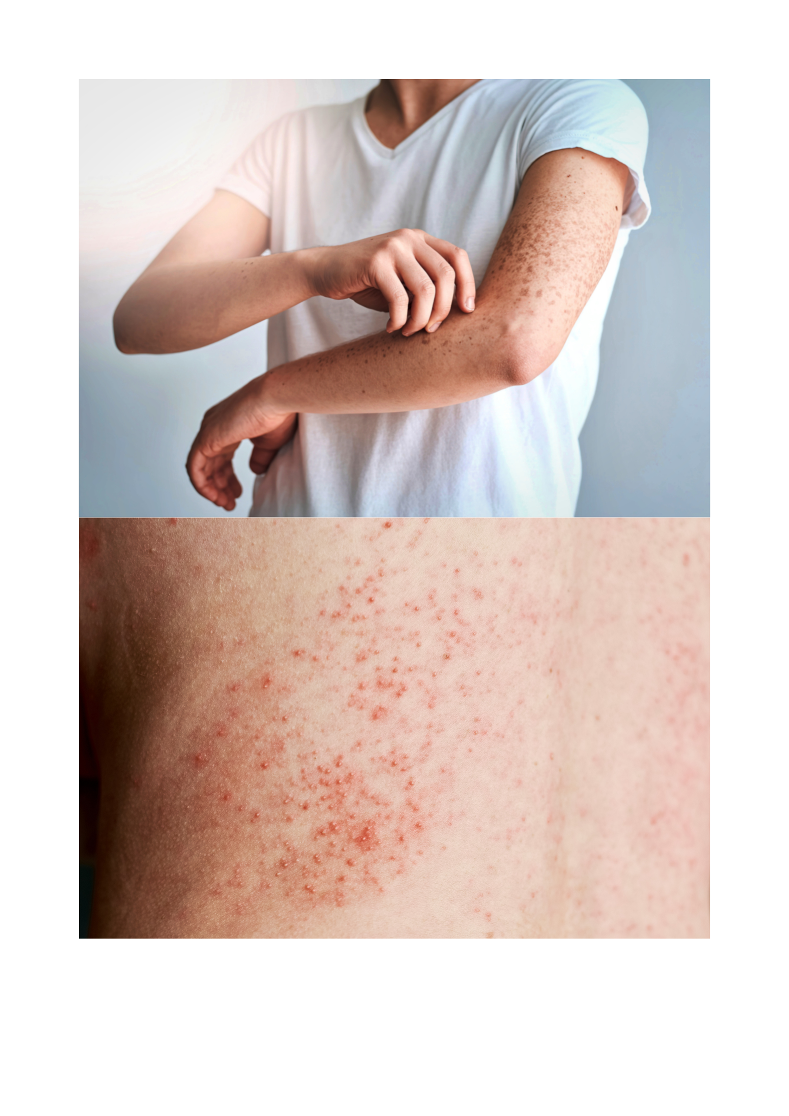 Skin Rashes in Summer Treatment Near Nagole Road – Gentle Skin Care at DR. Shwetha’s Homeopathy